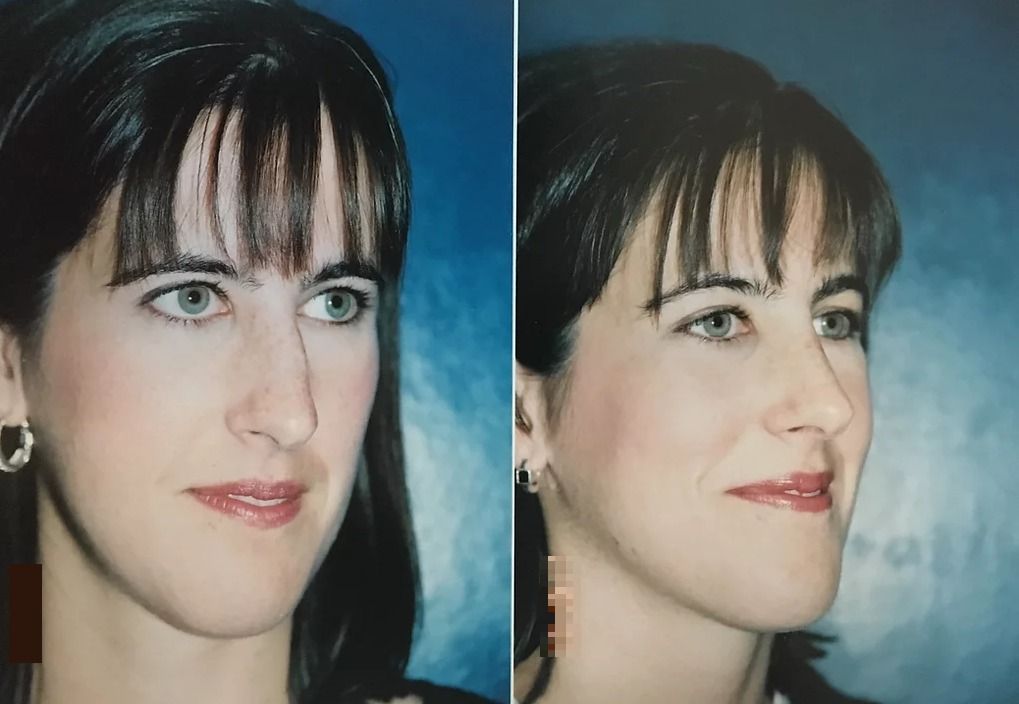 Gallery Royce Plastic & Reconstructive Surgery PA