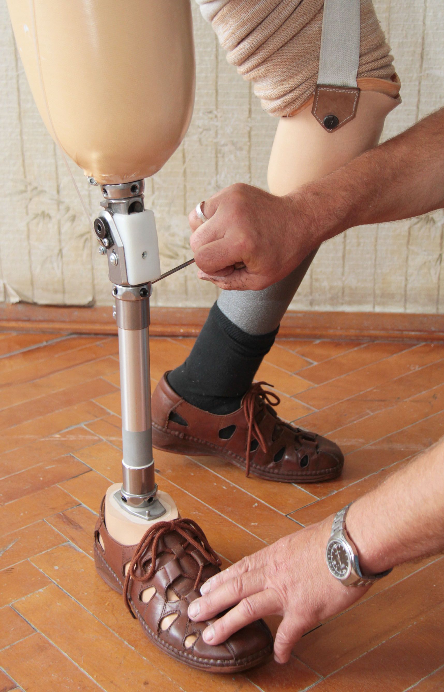 Louisville Prosthetics