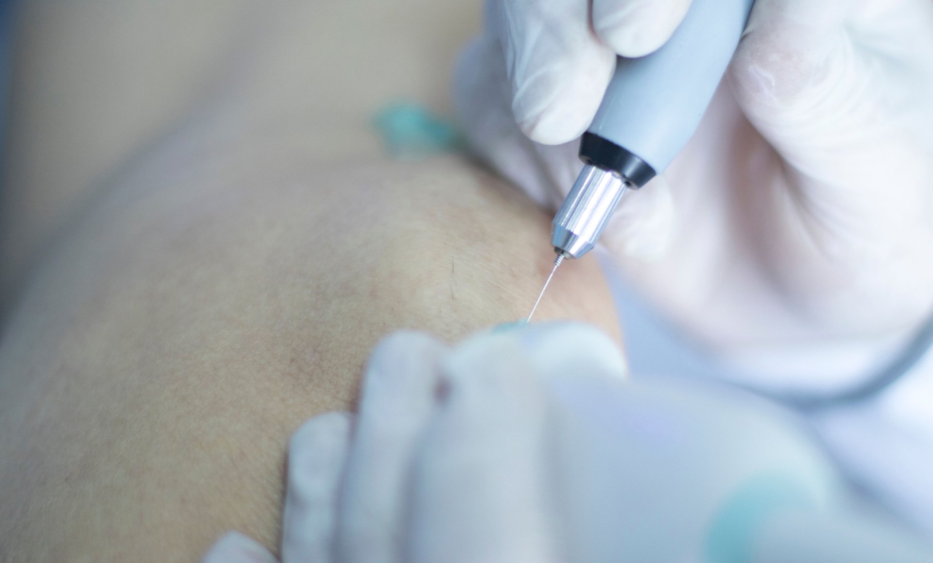 Electrolysis & Skin Care Of Topeka Hair Removal Topeka KS