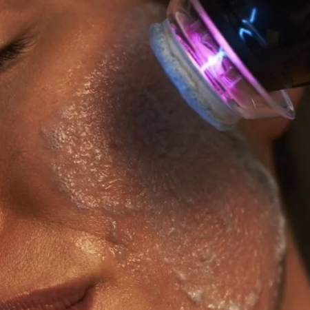 Woman receiving facial treatment; device emits blue light, applied to wet skin.
