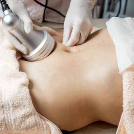 Person receiving radiofrequency body sculpting on abdomen with gloved hands.